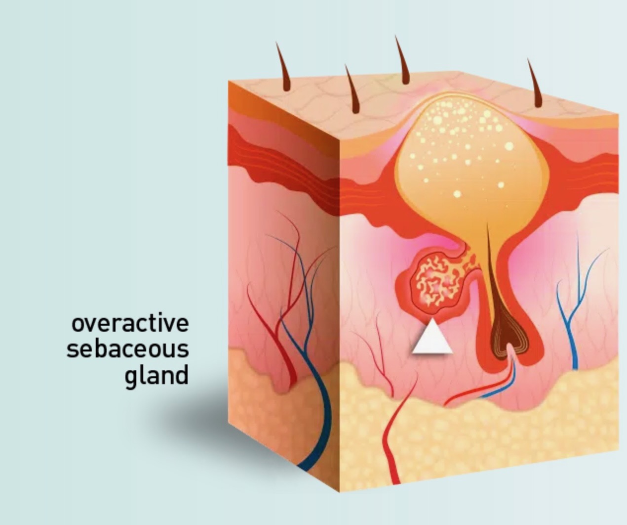 Skin diagram